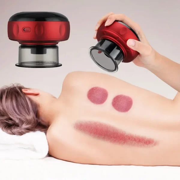 Electric Cupping Set: Intelligent Relief for Back and Neck Pain - Image 6